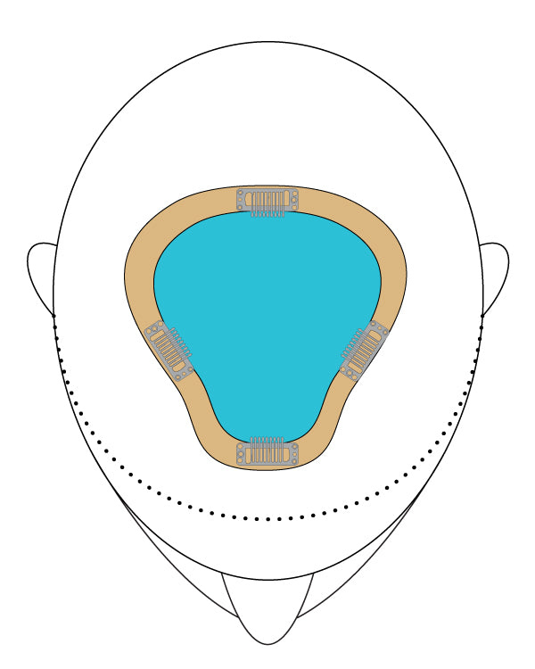 easiPart HH XL 8"